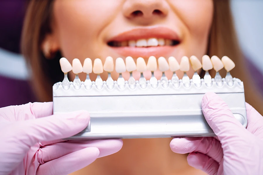Cosmetische tandheelkunde